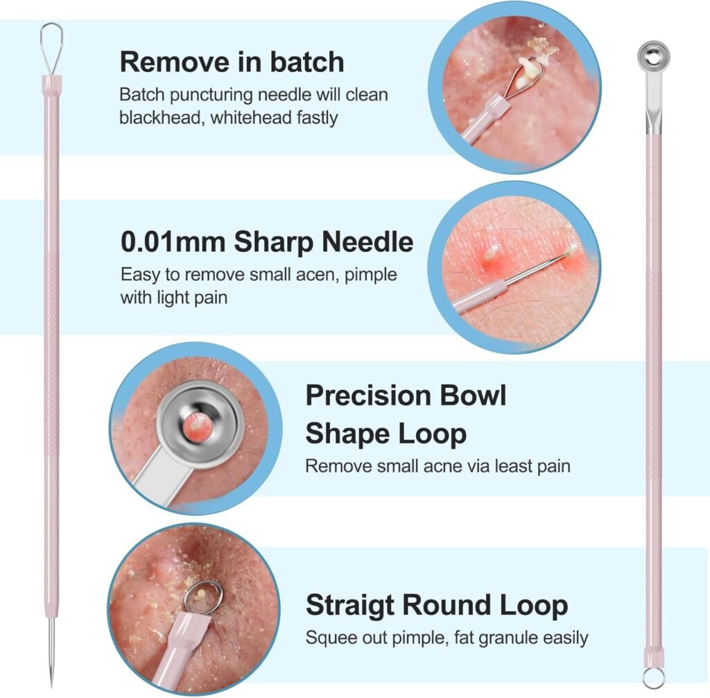 UWOIST Pimple Popper Tool Kit Review 2026: Is This 5-Piece Stainless Steel Set Safe for At-Home Extractions? (H2) If You