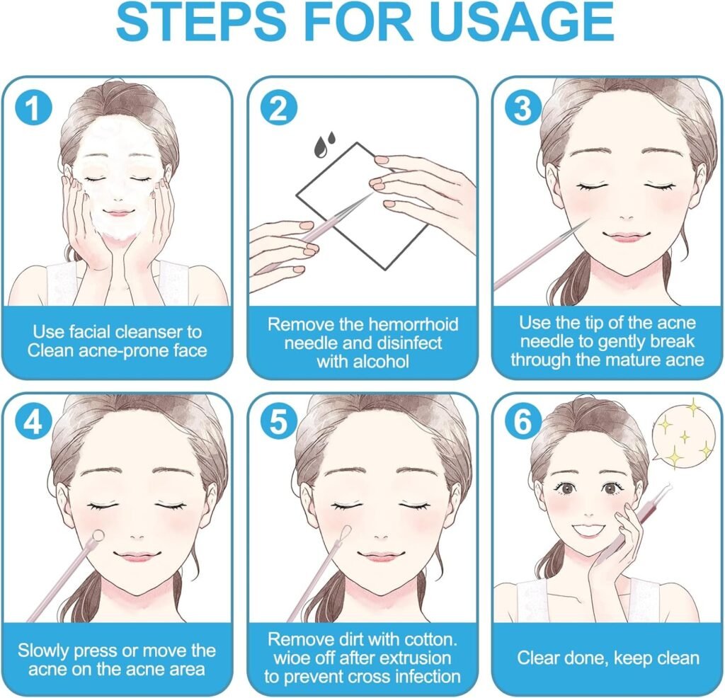 UWOIST Pimple Popper Tool Kit Review 2026: Is This 5-Piece Stainless Steel Set Safe for At-Home Extractions? (H2) If You