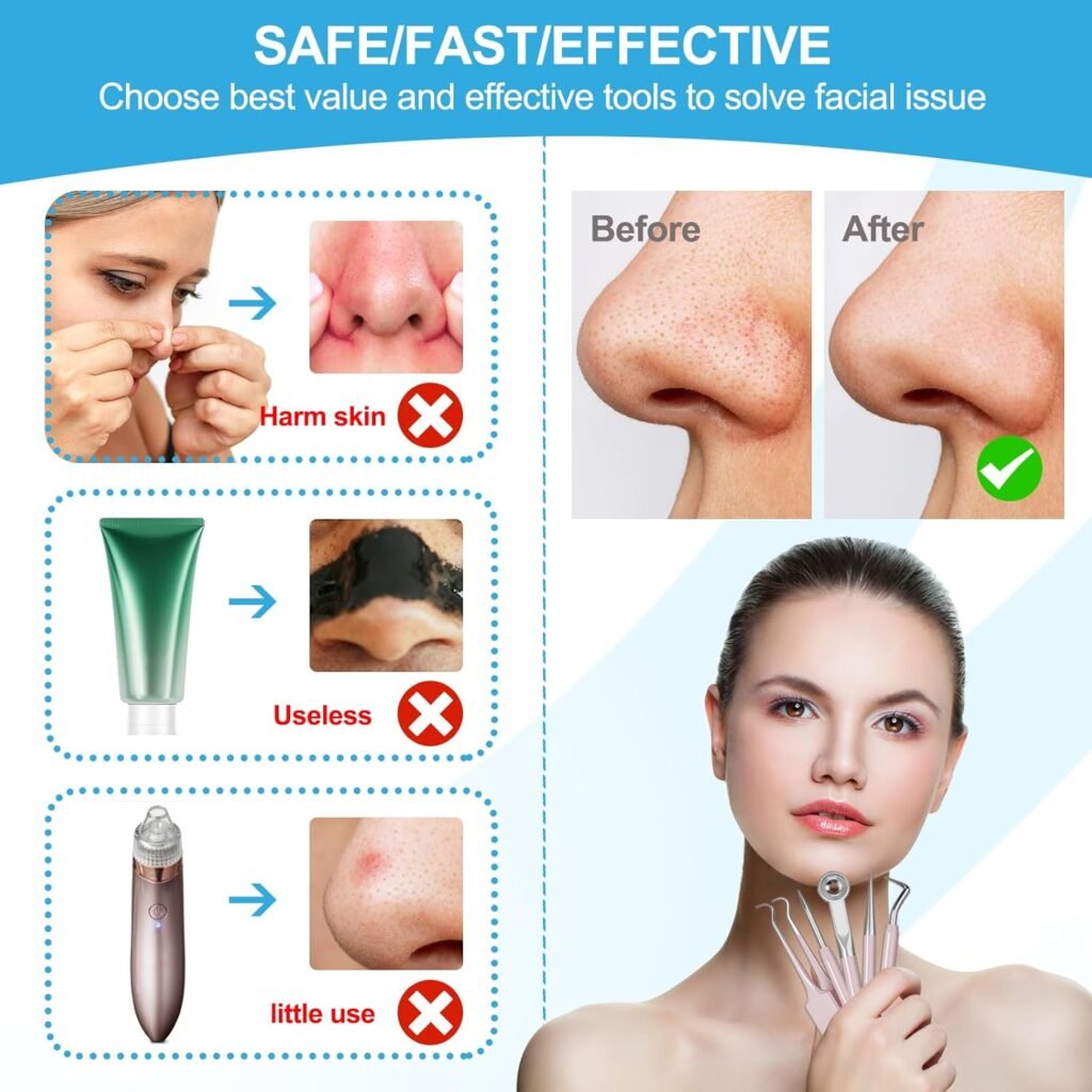 UWOIST Pimple Popper Tool Kit Review 2026: Is This 5-Piece Stainless Steel Set Safe for At-Home Extractions? (H2) If You