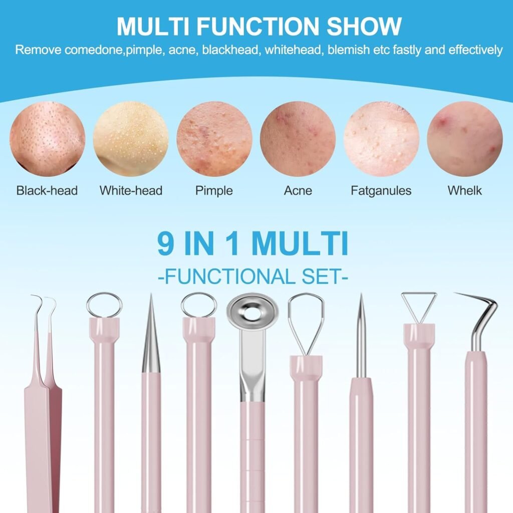 UWOIST Pimple Popper Tool Kit Review 2026: Is This 5-Piece Stainless Steel Set Safe for At-Home Extractions? (H2) If You