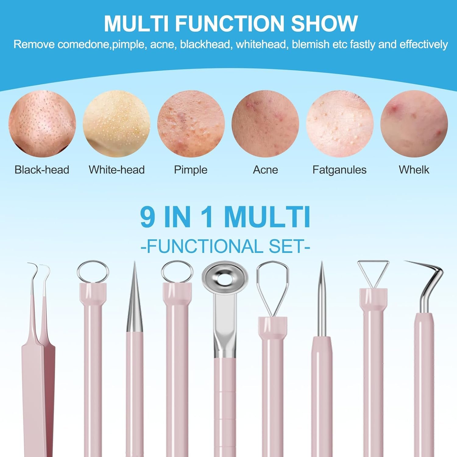 A 5-piece pink stainless steel blackhead remover tool kit, including various loop tools, sharp needles, and tweezers, all next to a small portable case, was laid out on a clean white surface.