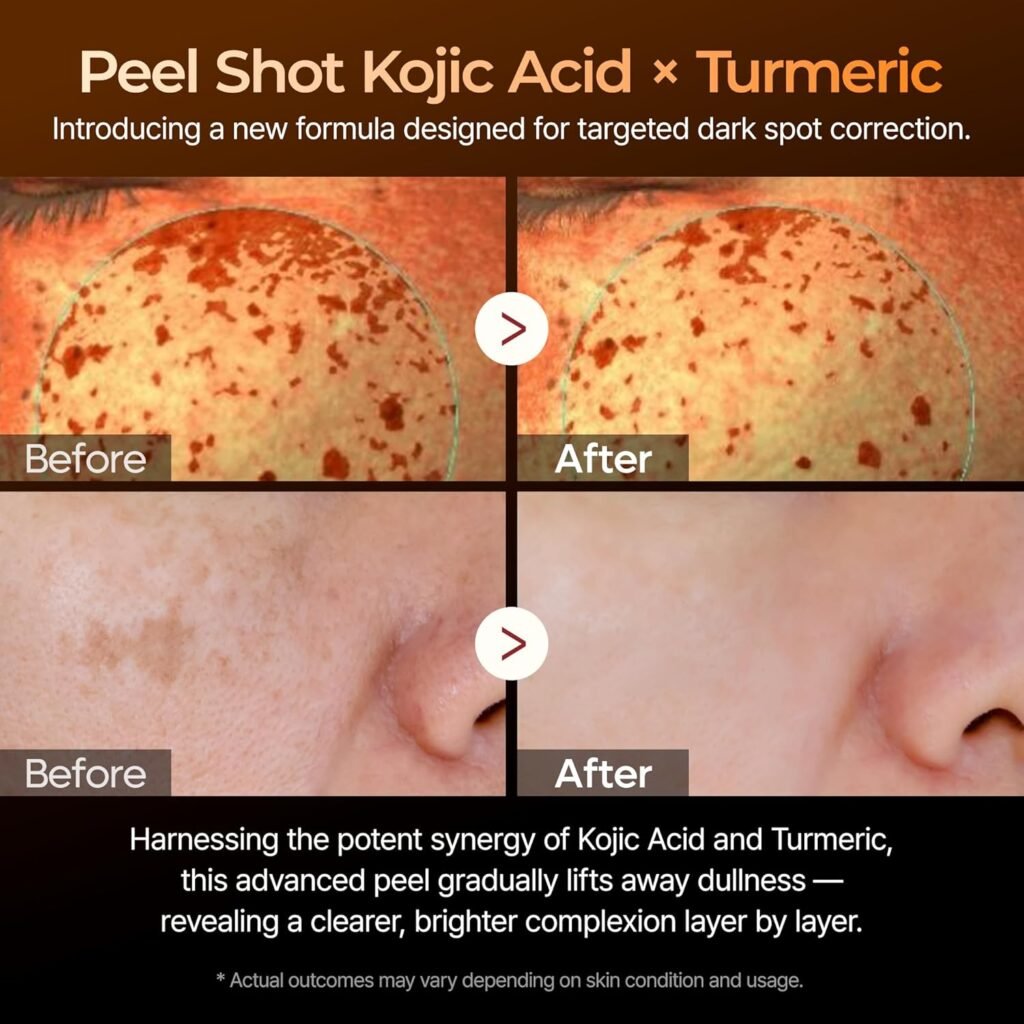 Dr. Melaxin Peel Shot Review 2026: Does This Kojic Acid & Turmeric Serum Really Fade Dark Spots? Dr. Melaxin Peel Shot exfoliating serum with kojic acid, turmeric, and glycolic acid for brighter skin
